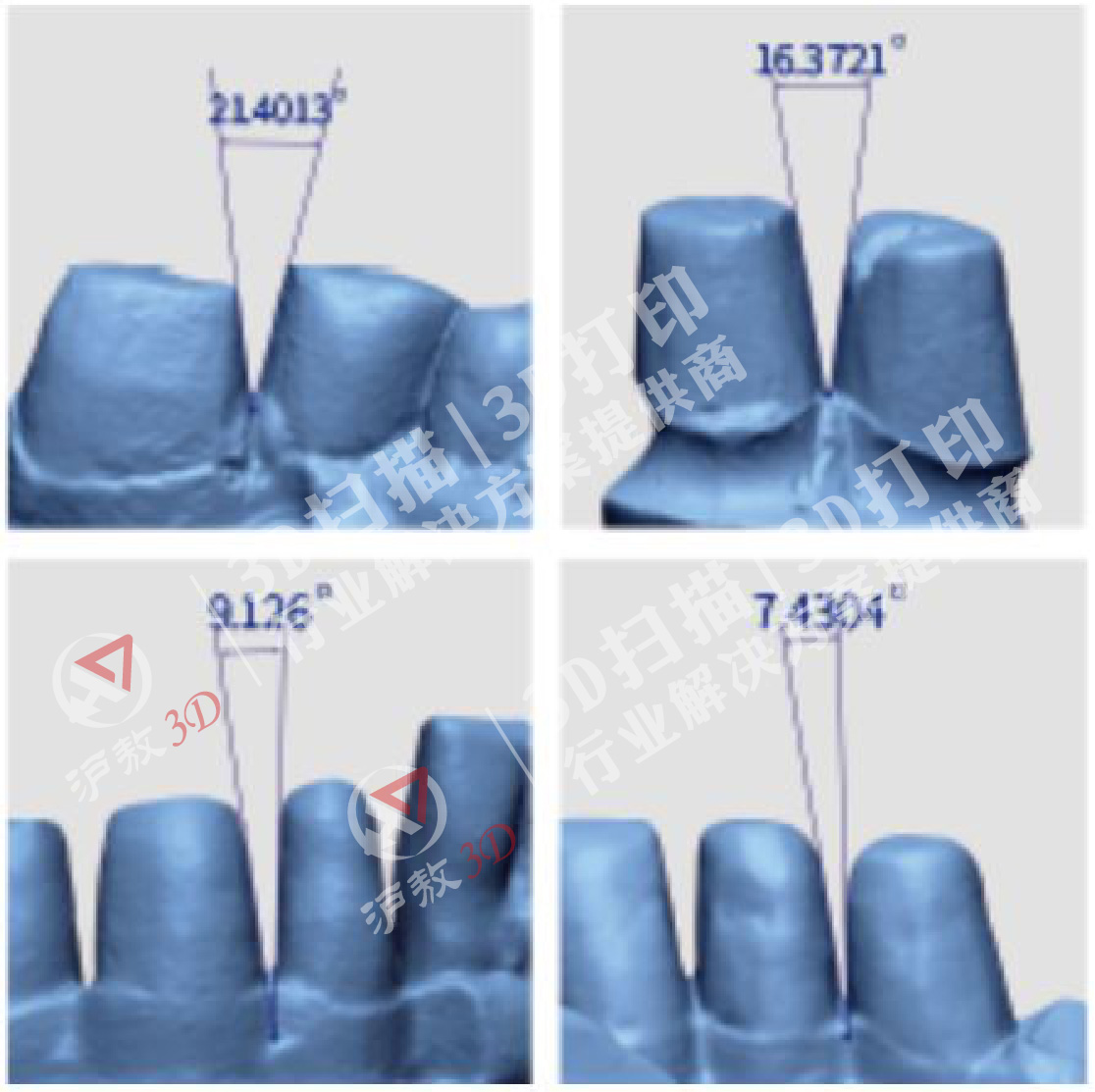 【上海滬敖3D】三維掃描在公共安全領域的應用⑤-5、人牙咬痕個體識別